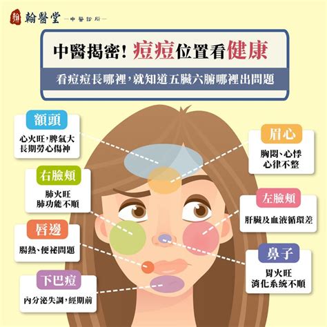 痘痘位子|青春痘、下巴痘痘長這個位置代表什麼意思？先弄懂長。